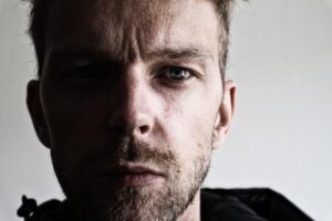 生理前のニキビを抑える方法は何ですか？